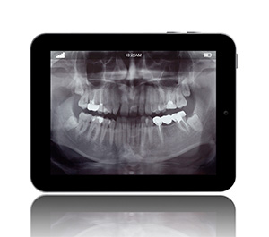 West Los Angeles dentist | digital dental x-rays| Le Chic Dentist