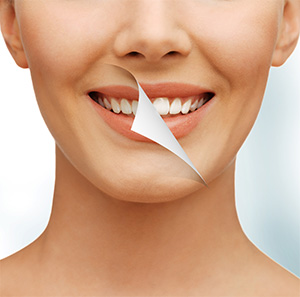 West Los Angeles cosmetic dentist |teeth whitening, white teeth| Le Chic Dentist